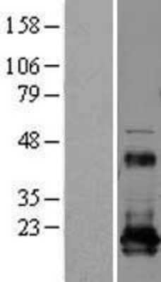 Western Blot: REEP5 Overexpression Lysate [NBL1-15269]