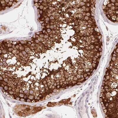 Immunohistochemistry: REEP6 Antibody [NBP2-37919]