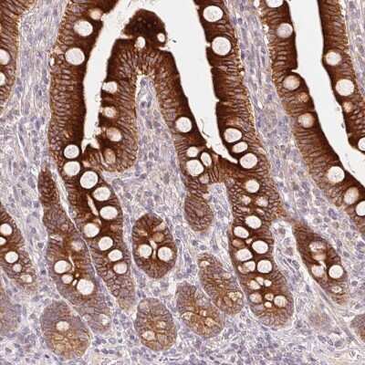 Immunohistochemistry-Paraffin: REEP6 Antibody [NBP2-37919]