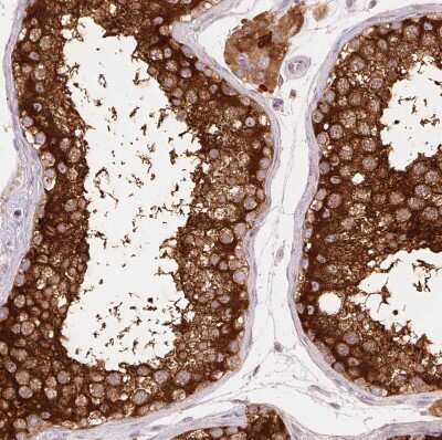 Immunohistochemistry-Paraffin: REEP6 Antibody [NBP2-37919]
