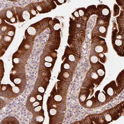 Immunohistochemistry-Paraffin: REEP6 Antibody [NBP2-37919]