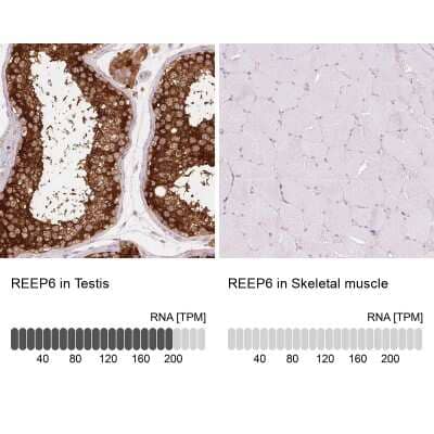 Immunohistochemistry-Paraffin: REEP6 Antibody [NBP2-37919]