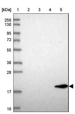 Western Blot: REEP6 Antibody [NBP2-37919]