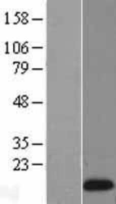 Western Blot: Reg1A Overexpression Lysate [NBL1-15271]