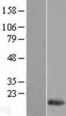 Western Blot: Reg1B Overexpression Lysate [NBL1-15272]