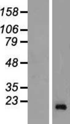 Western Blot: Reg3G Overexpression Lysate [NBP2-04702]