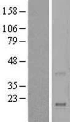 Western Blot: Reg4 Overexpression Lysate [NBL1-15275]