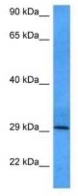 Western Blot: RELL2 Antibody [NBP3-10023]