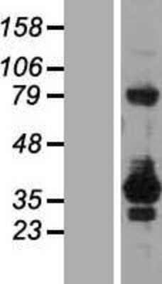 Western Blot: RELL2 Overexpression Lysate [NBL1-15277]