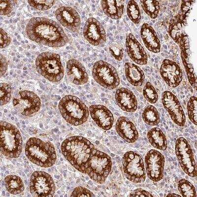 Immunohistochemistry-Paraffin: RELM beta Antibody [NBP2-13218]