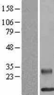 Western Blot: RELM beta Overexpression Lysate [NBL1-15288]