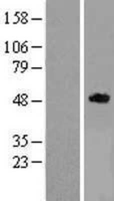 Western Blot: RELT/TNFRSF19L Overexpression Lysate [NBL1-15278]