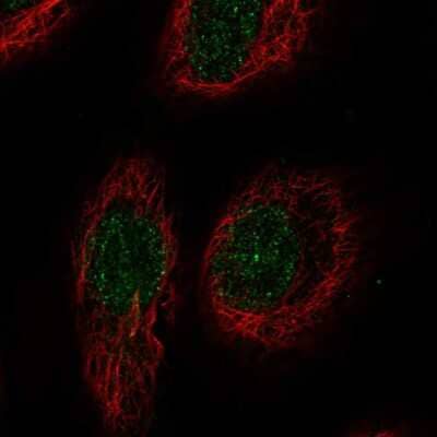 Immunocytochemistry/ Immunofluorescence: RELT/TNFRSF19L Antibody [NBP2-57601]