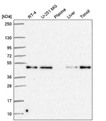 Western Blot: RELT/TNFRSF19L Antibody [NBP2-56851]