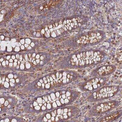 Immunohistochemistry-Paraffin: REM1 Antibody [NBP2-13217]