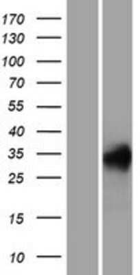 Western Blot: REM1 Overexpression Lysate [NBP2-07388]