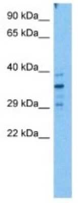 Western Blot: REM2 Antibody [NBP3-10017]