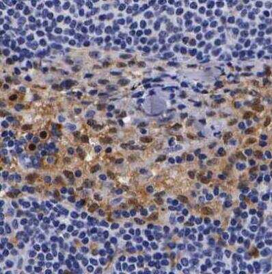 Immunohistochemistry-Paraffin: RENBP Antibody [NBP1-80851]