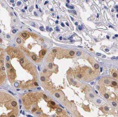 Immunohistochemistry-Paraffin: RENBP Antibody [NBP1-80851]