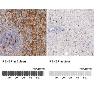 Immunohistochemistry-Paraffin: RENBP Antibody [NBP1-80852]