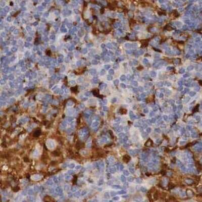 Immunohistochemistry-Paraffin: RENBP Antibody [NBP1-80852]