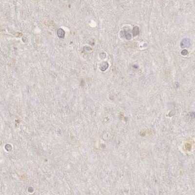 Immunohistochemistry-Paraffin: RENBP Antibody [NBP1-80852]