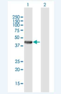 Western Blot: RENBP Antibody [H00005973-B01P-50ug]