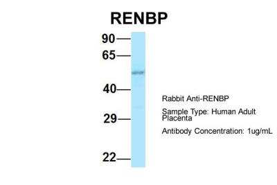 Western Blot: RENBP Antibody [NBP2-88139]