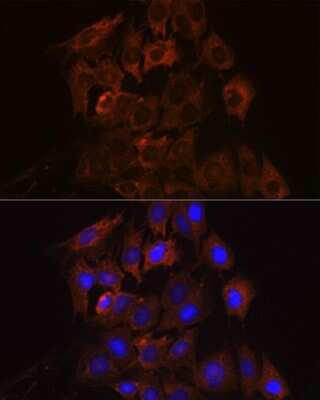 Immunocytochemistry/ Immunofluorescence: RENT1/UPF1/hUPF1 Antibody (5D5C4) [NBP3-16544]