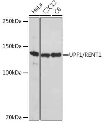 Western Blot: RENT1/UPF1/hUPF1 Antibody (5D5C4) [NBP3-16544]