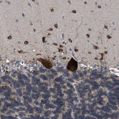 Immunohistochemistry-Paraffin: RENT1/UPF1/hUPF1 Antibody [NBP1-89642]