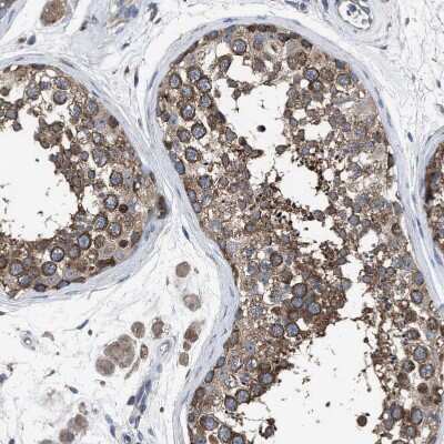Immunohistochemistry-Paraffin: RENT1/UPF1/hUPF1 Antibody [NBP1-89642]