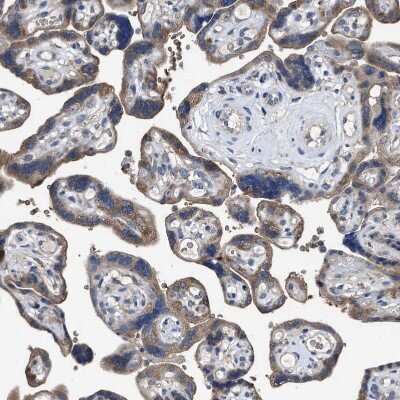 Immunohistochemistry-Paraffin: RENT1/UPF1/hUPF1 Antibody [NBP1-89642]