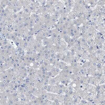 Immunohistochemistry-Paraffin: RENT1/UPF1/hUPF1 Antibody [NBP1-89642]