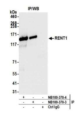 Immunoprecipitation: RENT1/UPF1/hUPF1 Antibody [NB100-370]
