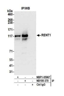 Immunoprecipitation: RENT1/UPF1/hUPF1 Antibody [NBP1-05967]