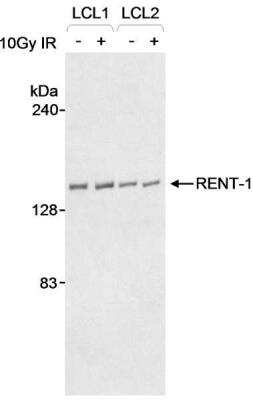 Western Blot: RENT1/UPF1/hUPF1 Antibody [NB100-368]