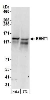 Western Blot: RENT1/UPF1/hUPF1 Antibody [NB100-368]