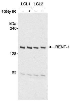 Western Blot: RENT1/UPF1/hUPF1 Antibody [NB100-370]