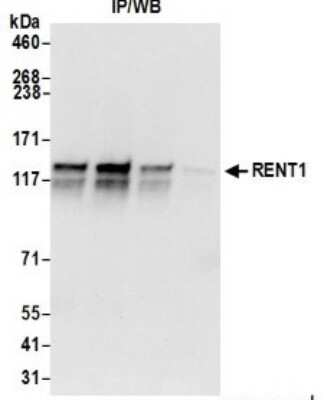 Western Blot: RENT1/UPF1/hUPF1 Antibody [NB100-370]