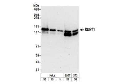 Western Blot: RENT1/UPF1/hUPF1 Antibody [NB100-370]