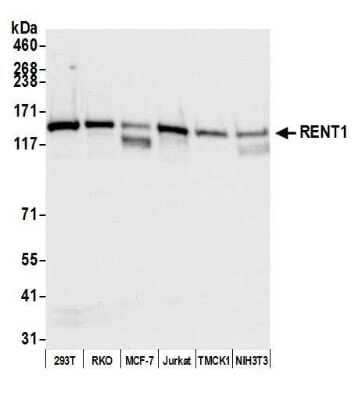 Western Blot: RENT1/UPF1/hUPF1 Antibody [NB100-370]