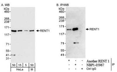 Western Blot: RENT1/UPF1/hUPF1 Antibody [NBP1-05967]