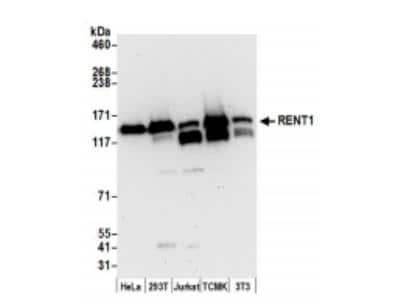 Western Blot: RENT1/UPF1/hUPF1 Antibody [NBP1-05967]