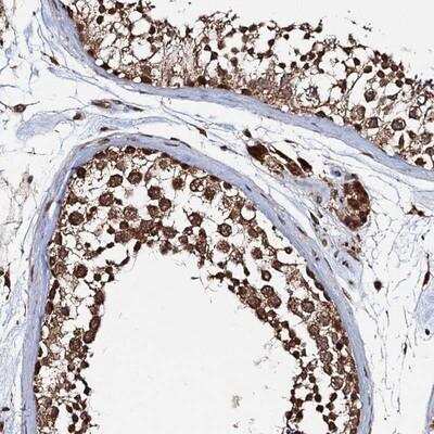 Immunohistochemistry: REP15 Antibody [NBP1-93441]