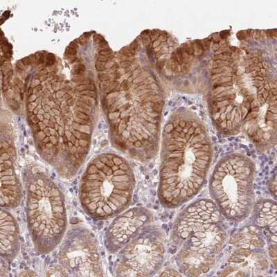 Immunohistochemistry: REP15 Antibody [NBP2-49307]