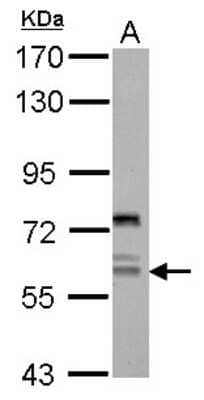 Western Blot: REPIN1 Antibody [NBP2-20125]