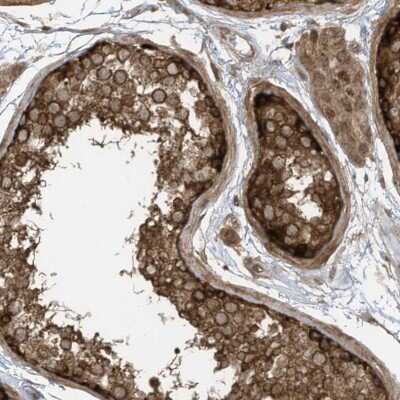 Immunohistochemistry: REPS1 Antibody [NBP2-38147]