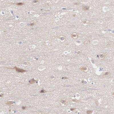 Immunohistochemistry-Paraffin: REPS2 Antibody [NBP1-80892]