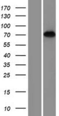 Western Blot: REPS2 Overexpression Lysate [NBP2-07838]